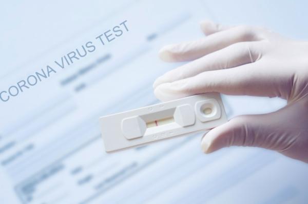 Για ποιες ομάδες πληθυσμού είναι υποχρεωτικό το self test - Aρχές Απριλίου η διάθεσή του στα φαρμακεία