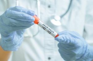 302 νέα κρούσματα Κορωνοϊού και δύο θάνατοι το τελευταίο 24ωρο, 53 οι διασωληνωμένοι