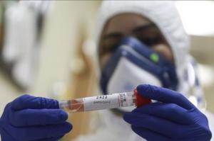 170 νέα κρούσματα Κορωνοϊoύ, 78 οι διασωληνωμένοι