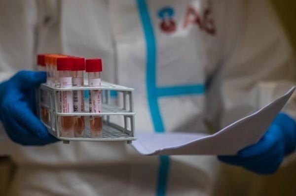 436 νέα κρούσματα Κορωνοϊού στην χώρα, 91 διασωληνωμένοι και 6 θάνατοι