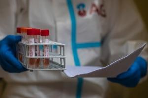 286 κρούσματα Κορωνοϊού και 3 νέοι θάνατοι το τελευταίο 24ωρο