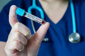 436 κρούσματα Κορωνοϊού στην χώρα και 7 θάνατοι το τελευταίο 24ωρο