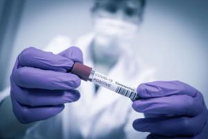 3038 νέα κρούσματα Κορωνοϊού στη χώρα, 336 διασωληνωμένοι και 38 ακόμα θάνατοι